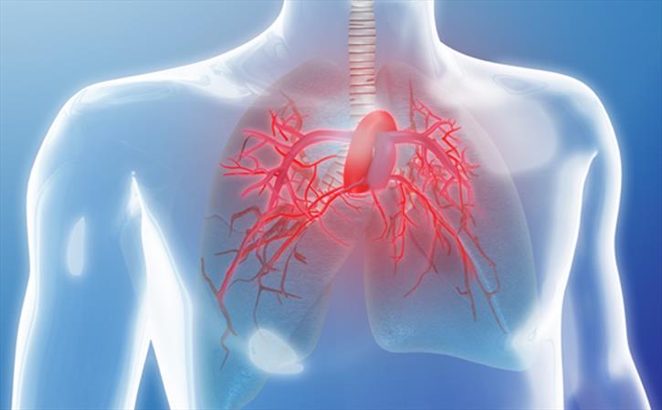 Pulmonary Hypertension